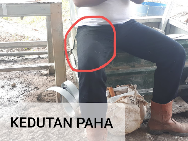 Kedutan-paha Kedutan paha kanan